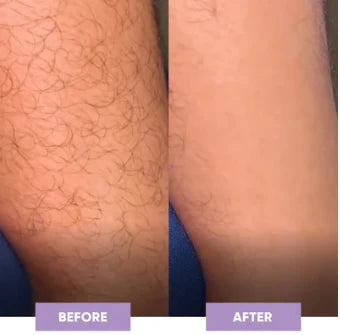 GlowShave™Pour une peau lisse et éclatante.