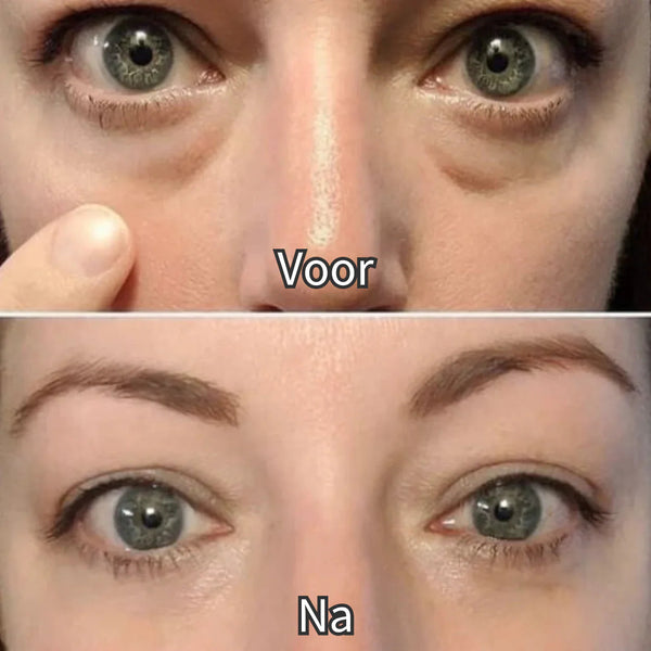EyeShine™ Lumière rouge et EMS Réduit les cernes sous les yeux.